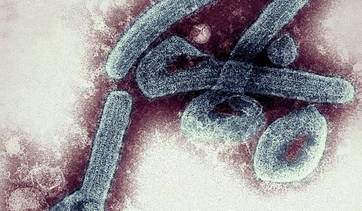 Marburg virus